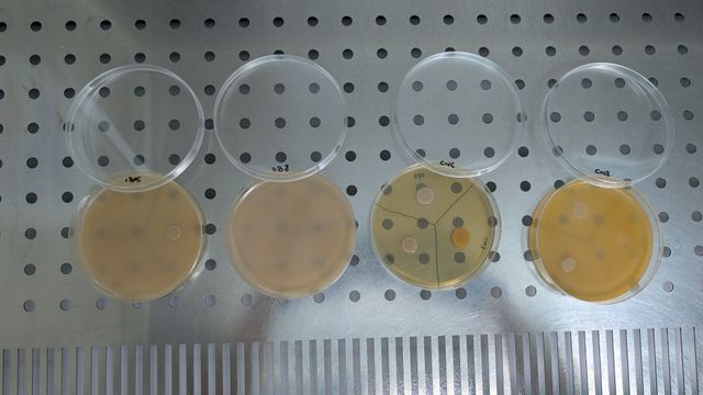 Results from the antagonism testing. Photo courtesy of the artist
